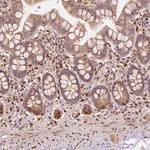 TBC1D17 Polyclonal Antibody