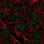 CTR9 Polyclonal Antibody