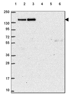 CTR9 Antibody in Western Blot (WB)