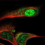 ZNF286B Polyclonal Antibody