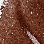 ZNF286B Antibody in Immunohistochemistry (Paraffin) (IHC (P))