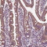 SLC22A18AS Antibody in Immunohistochemistry (IHC)