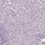 SLC22A18AS Antibody in Immunohistochemistry (IHC)
