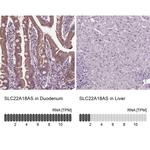 SLC22A18AS Antibody
