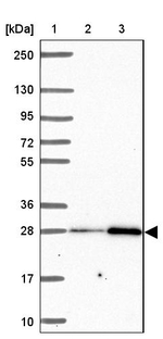 SLC22A18AS Antibody in Western Blot (WB)