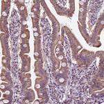 SLC22A18AS Antibody in Immunohistochemistry (IHC)