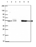 EP400NL Antibody in Western Blot (WB)