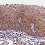 ASB18 Polyclonal Antibody