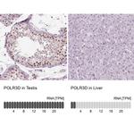 POLR3D Antibody in Immunohistochemistry (IHC)