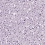 POLR3D Antibody in Immunohistochemistry (IHC)