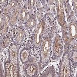 FASTKD3 Polyclonal Antibody