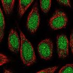 ZNF879 Polyclonal Antibody