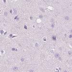CUZD1 Antibody in Immunohistochemistry (IHC)