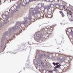 LZTR1 Antibody in Immunohistochemistry (Paraffin) (IHC (P))