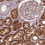 BABAM1 Antibody in Immunohistochemistry (Paraffin) (IHC (P))