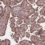 BABAM1 Antibody in Immunohistochemistry (Paraffin) (IHC (P))