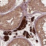 BABAM1 Antibody in Immunohistochemistry (Paraffin) (IHC (P))