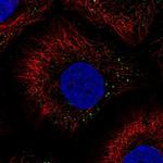 PHGR1 Polyclonal Antibody