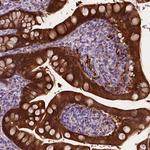 PHGR1 Antibody in Immunohistochemistry (Paraffin) (IHC (P))