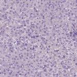 PHGR1 Antibody in Immunohistochemistry (IHC)