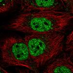 KIAA0040 Polyclonal Antibody