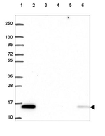 KIAA0040 Antibody in Western Blot (WB)