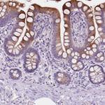 IREB2 Polyclonal Antibody