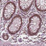 POLR2E Polyclonal Antibody