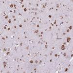 RPL29 Antibody in Immunohistochemistry (Paraffin) (IHC (P))