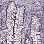 SMIM1 Antibody in Immunohistochemistry (Paraffin) (IHC (P))
