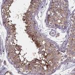 SMIM1 Antibody in Immunohistochemistry (Paraffin) (IHC (P))
