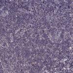 SMIM1 Antibody in Immunohistochemistry (Paraffin) (IHC (P))