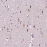 LRP1B Antibody in Immunohistochemistry (Paraffin) (IHC (P))