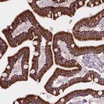 LRP1B Antibody in Immunohistochemistry (Paraffin) (IHC (P))