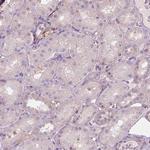 LRP1B Antibody in Immunohistochemistry (Paraffin) (IHC (P))