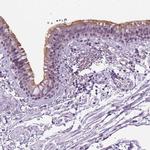 MMP27 Polyclonal Antibody