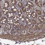 PCID2 Antibody in Immunohistochemistry (Paraffin) (IHC (P))