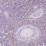 GDF9 Polyclonal Antibody