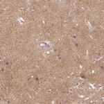 Neuroligin 2 Polyclonal Antibody
