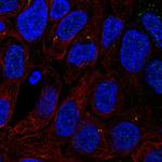 TTC6 Polyclonal Antibody