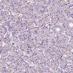 PRR35 Polyclonal Antibody