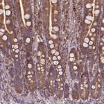 JIP3 Polyclonal Antibody