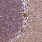 PHYHIP Antibody in Immunohistochemistry (IHC)