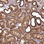 MTCO1 Polyclonal Antibody