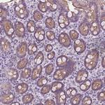 EPPK1 Antibody in Immunohistochemistry (Paraffin) (IHC (P))