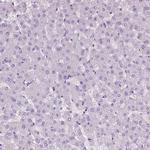 EPPK1 Antibody in Immunohistochemistry (Paraffin) (IHC (P))