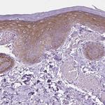 EPPK1 Antibody in Immunohistochemistry (Paraffin) (IHC (P))