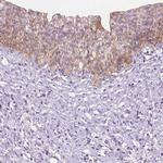EPPK1 Antibody in Immunohistochemistry (Paraffin) (IHC (P))