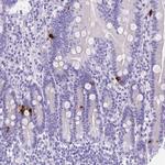 Motilin Antibody in Immunohistochemistry (IHC)