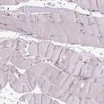 GLB1 Antibody in Immunohistochemistry (Paraffin) (IHC (P))